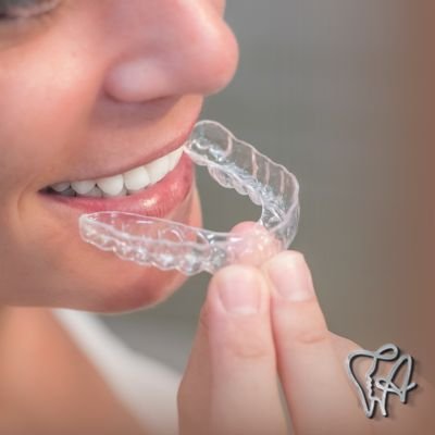 Alinhador Transparente - Aparelhos Invisíveis