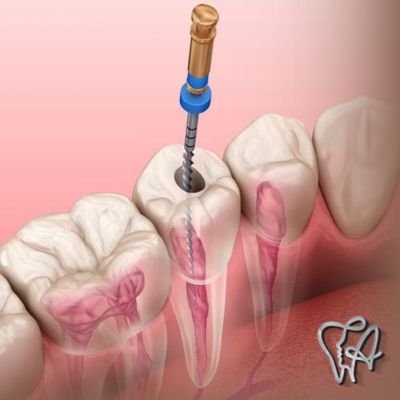 Canal dentário em Taboão em Guarulhos