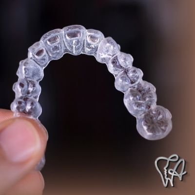 Invisalign alinhador transparente na Vila Fatima em Guarulhos